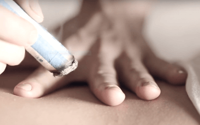 Moxa — Moxibustion