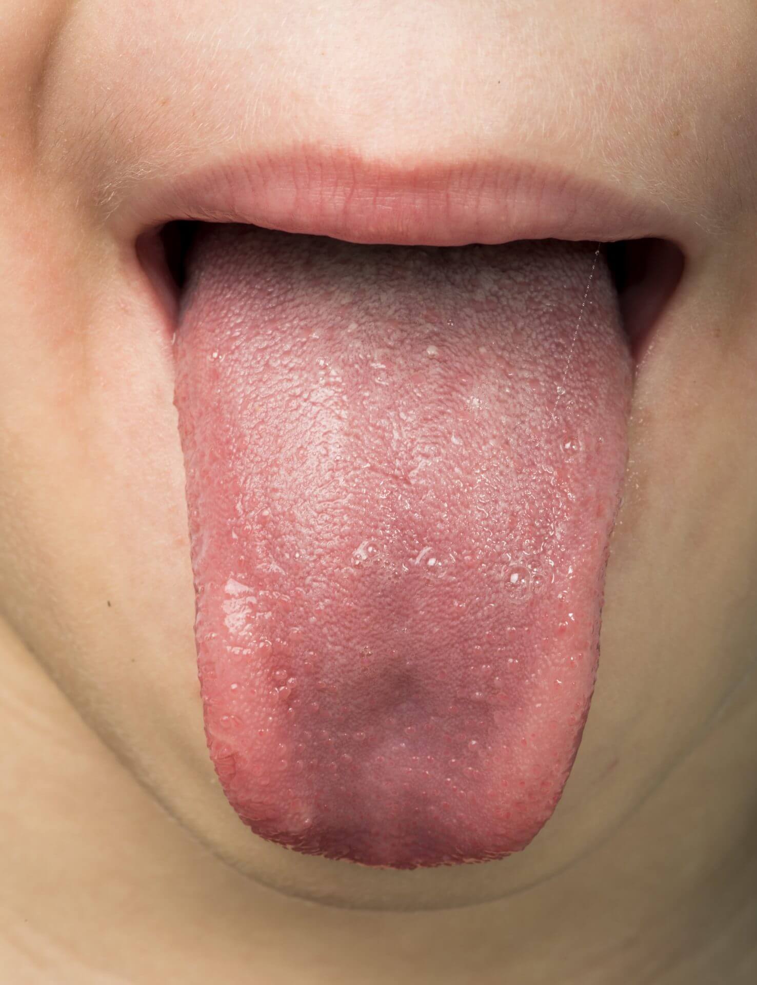 Human tongue protruding out